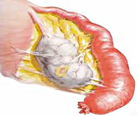 Inflamarea fanere - cauze, simptome, diagnostic și tratament