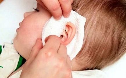 dureri de urechi - cum să trateze