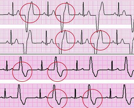 Bate-l, cauze, simptome, diagnostic și tratament