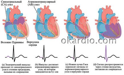 Simptomele fibrilatie atriala, tratamentul si forma prognostic