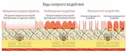 termoliz- fracțional ce este, esența procedurii și acțiunea