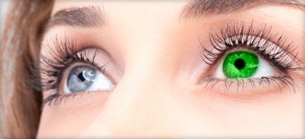 Ochii de culoare diferită (heterocromie), aceasta înseamnă că raznoglaziya cauze (foto)