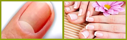 Modificări ale unghiilor - semnalează despre starea de sanatate a organismului