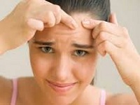 Cum să scapi de acnee pe fata ta la domiciliu, medicina tradițională