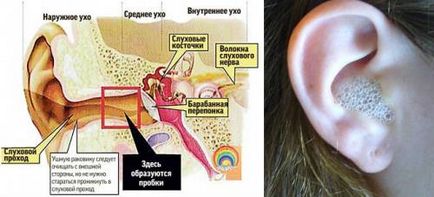 Cum picurare peroxid de hidrogen în curățarea ureche ureche de blocaje de trafic în copil