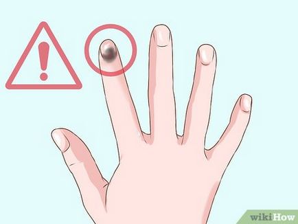 Cum de a lega degetul sau de la picior
