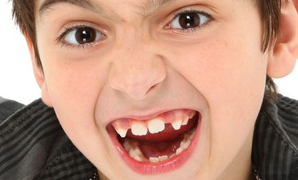 Cum de a smulge dinte copilul acasă într-un copil