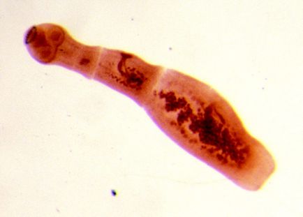 Tapeworms la om simptome și semne, fotografii