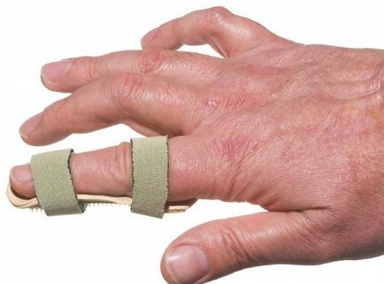 Umflarea degetul pe cauzele mâinilor și tratamente