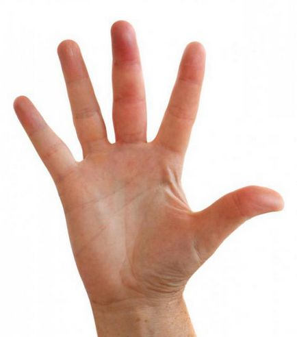 Umflarea degetul pe cauzele mâinilor și tratamente