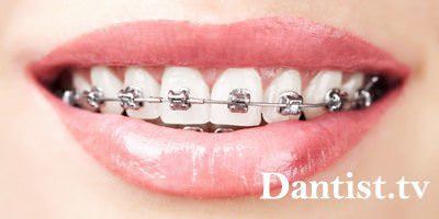 Ortodont care tratează acest lucru și că