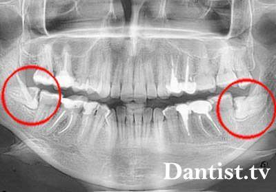 Ortodont care tratează acest lucru și că