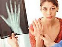 Osteoporoza este ceea ce este, simptomele si tratamentul bolilor osoase