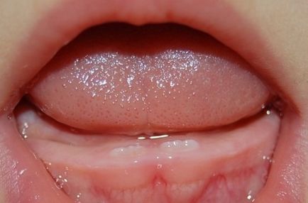 Secvența de erupție a dinților la copii (11 poze) cum de a urca simptome dintilor
