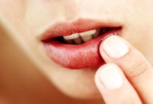 Cauzele simptomelor alergice pe buze și tratamentul lor
