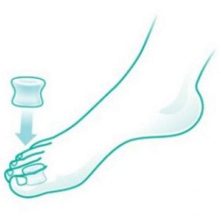Divizoare pentru degetele de la picioare ortopedice de silicon, gel, tesatura