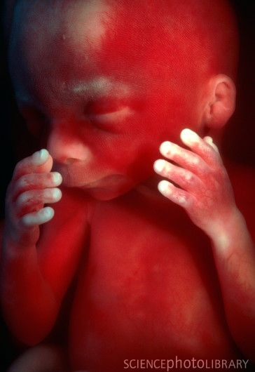 fetale săptămână de săptămână, cu fotografii uimitoare și imagini