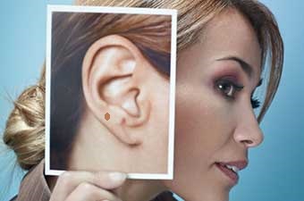 Mole asupra cauzelor urechii a sensului
