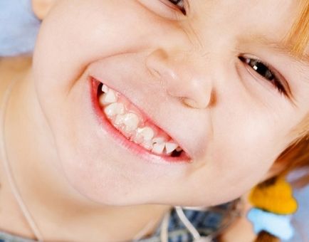 Cât de mulți dinți pentru copii ar trebui să fie numărul de dinți la copii