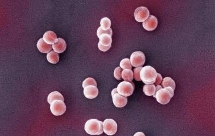 Staphylococcus ce este și cât de periculos