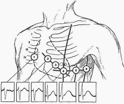 Tehnologia de electrocardiografie - studopediya