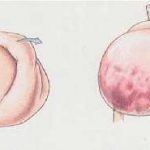 Câinele mârâind în abdomen, care nu mănâncă, provoacă stomac și gaze, vărsături decât pentru a trata la domiciliu (abdominală) Câinele mârâind în abdomen, care nu mănâncă, provoacă stomac și gaze, vărsături, decât să fie tratate la domiciliu