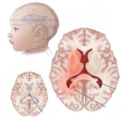 ecografie cerebrală pentru copii să facă, care arată