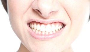 Ce se întâmplă dacă se clatină dinții cum de a consolida și de a salva molarii și produse lactate, întărirea gingiilor