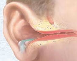 Puroi în cauze ale urechii, tratament, diagnostic