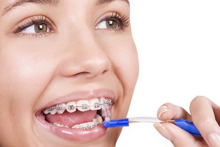 Malocluzie în tratamente pentru adulți și prețuri, servicii de stomatologie dentalsolution