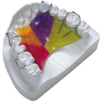 Rectificarea dinților (malocluzie) fara bretele - cauze, simptome și tratament