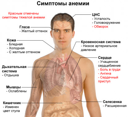 Cum de a trata anemia in casa, stimulantele hemoglobinei