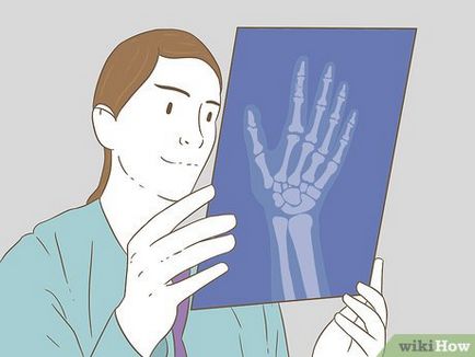 Cum pentru a determina dacă un deget este rupt