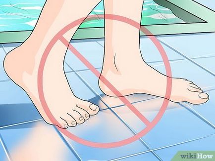 Cum de a vindeca ciuperca piciorului