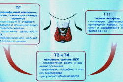Tratamentul bolii tiroidiene autoimune cauze simptome