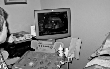 Norma parametri cu ultrasunete de rinichi, descifrarea care arata de cercetare