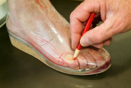 pantofi ortopedici ce este, cum funcționează și cum de a alege