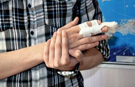 Un deget fracturat pe braț și picior simptomele sale, modul de a determina un tratament