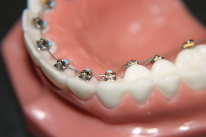 Profesionale zâmbet dentare clinica, ostomy (de asemenea, nostru) Dentare profesionale clinica zâmbet, ostomy