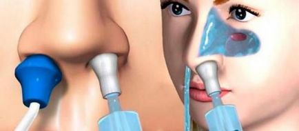 Clătirea nasul în sinusul în casă, precum și decât să se spele corect