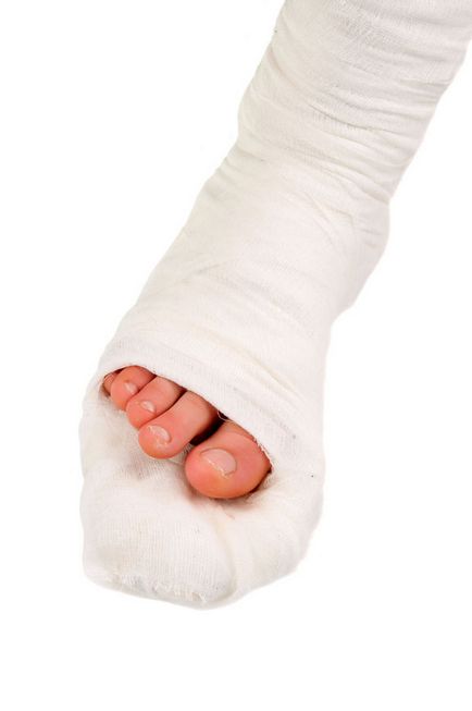 Ligamentele decalaj glezna - tratament și diagnostic pentru a afla! (Comun) Ligamentele decalaj glezna - tratament și diagnostic pentru a afla!
