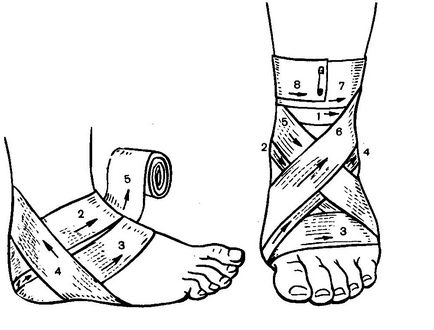 Ligamentele decalaj glezna - tratament și diagnostic pentru a afla!