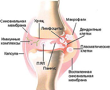 Restaurarea cartilajului pachetului comun de măsuri de genunchi pentru a vindeca
