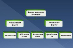 forme atipice de infarct miocardic