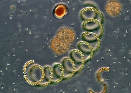 Bacteriile si microbii la microscop