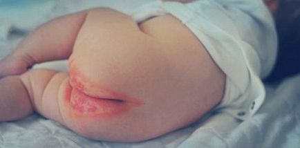 Lubrifia pielea după baie nou-născut, copilul nou-născut