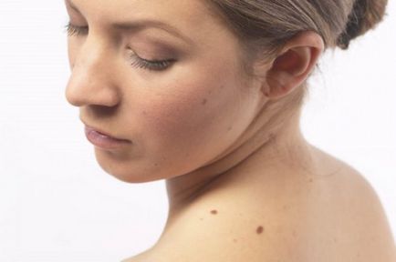 Ce se întâmplă dacă ai distruge sau deteriora birthmark ei