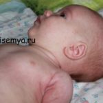 Dieta pentru rotavirus la copii, toți copiii și familia