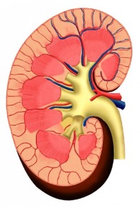 Limfom modificări ale parenchimul renale - cauze si tratament - tipuri de modificări difuze