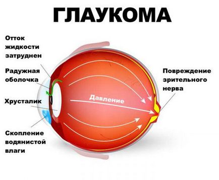 picături pentru ochi pentru taufon care desemnează, compoziția de medicament manualul de instrucțiuni